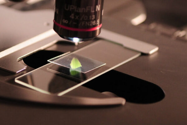 Wetenschappelijk darmonderzoek tijdens Leiden Marathon