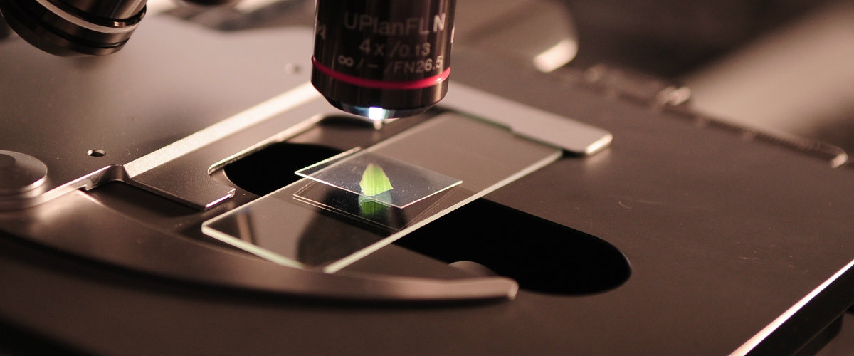 Wetenschappelijk darmonderzoek tijdens Leiden Marathon