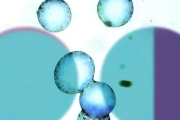 TV-uitzending over darmbacteriën maakt veel los