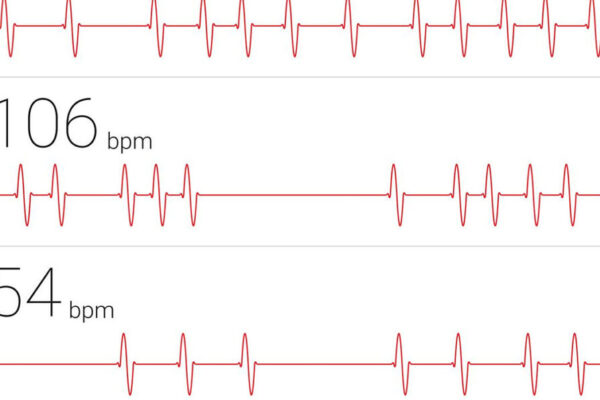 Sportwereld kweekvijver voor gezondheidszorg