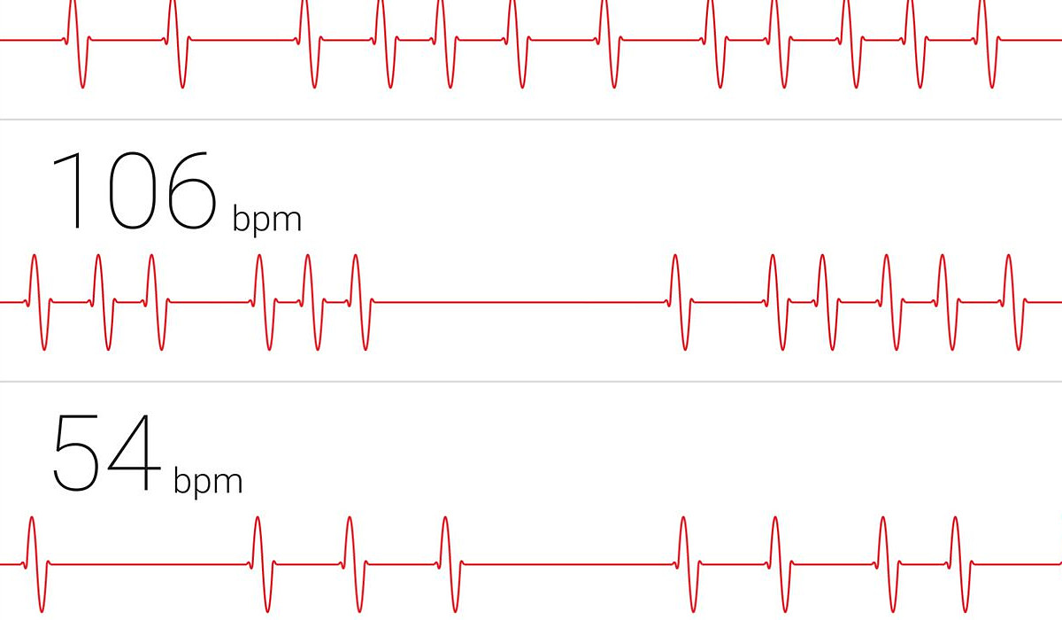 Sportwereld kweekvijver voor gezondheidszorg